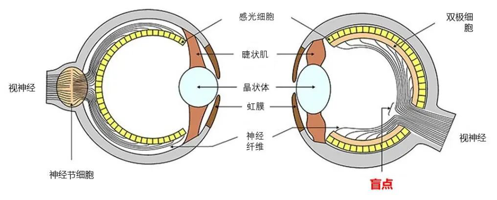 眼睛盲点图片